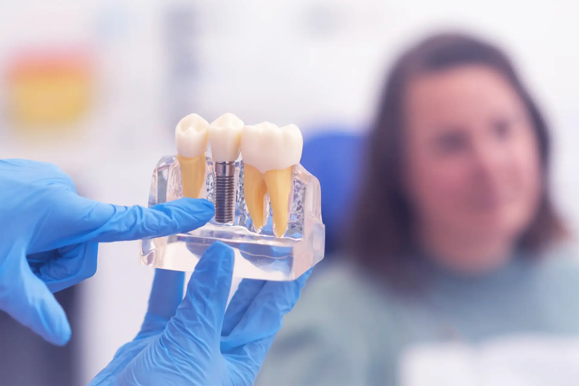 Dental Implants
