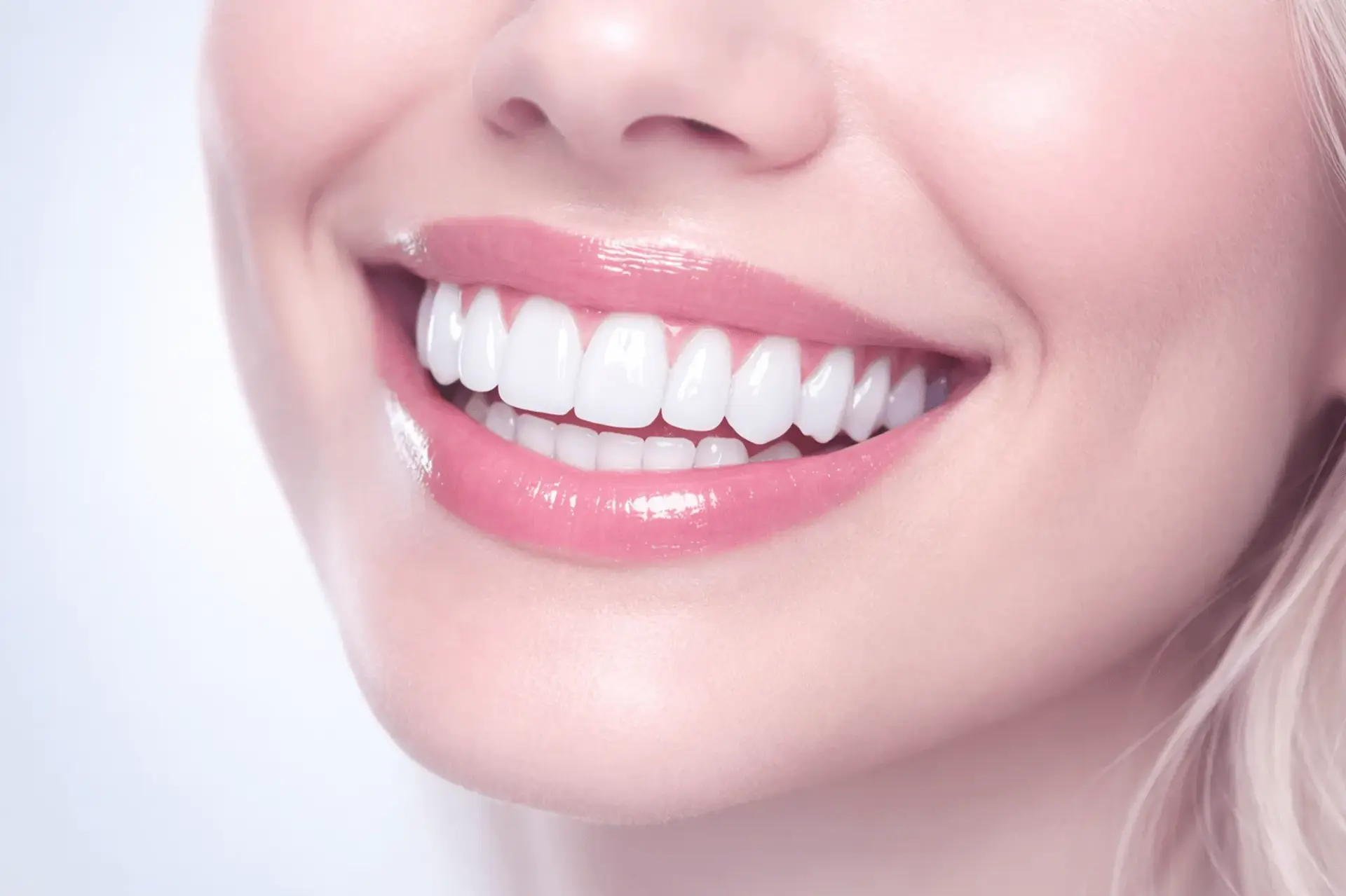 Hollywood Smile