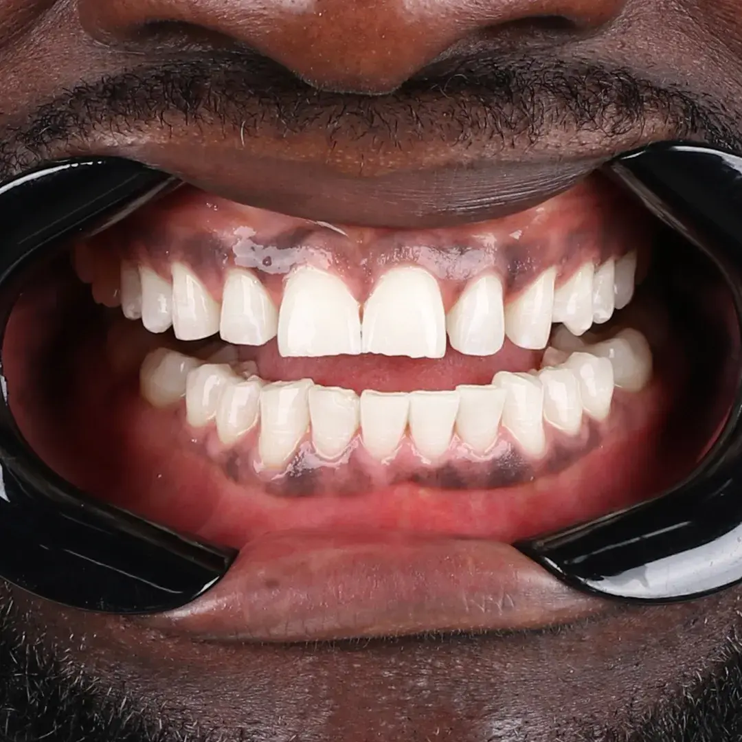 David Okafor - Nachher