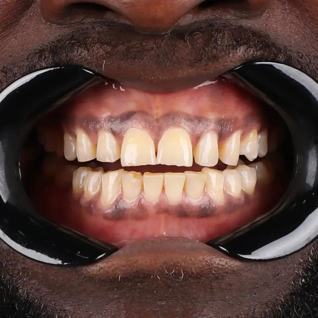 David Okafor - Vorher